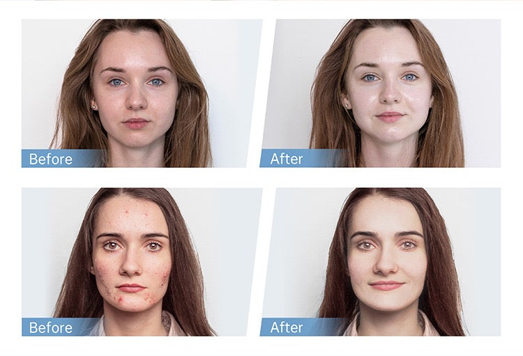 skinlabhk.myshopify.com Hydra.pen H5 Professional MTS 微電流EMS電動微針Microneedling Hydrapen