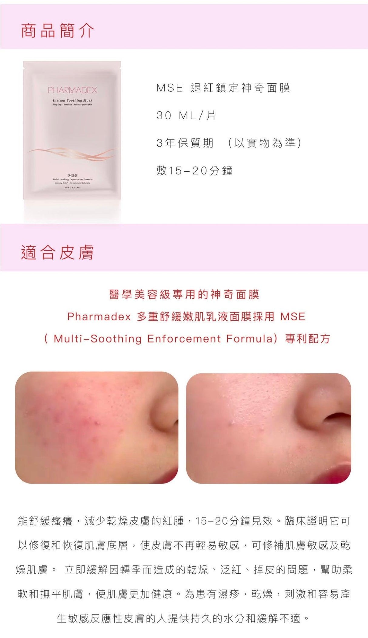 PHARMADEX MSE Instant Soothing Mask降紅修復補水面膜 - Beauty’s 5skin