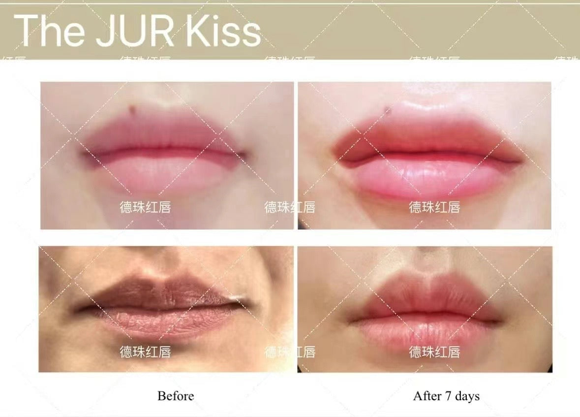 韓國德珠 紅唇針玻尿酸 The JUR Kiss  x 1.1 毫升 韓妹紅唇 免紋唇