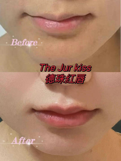 韓國德珠 紅唇針玻尿酸 The JUR Kiss  x 1.1 毫升 韓妹紅唇 免紋唇