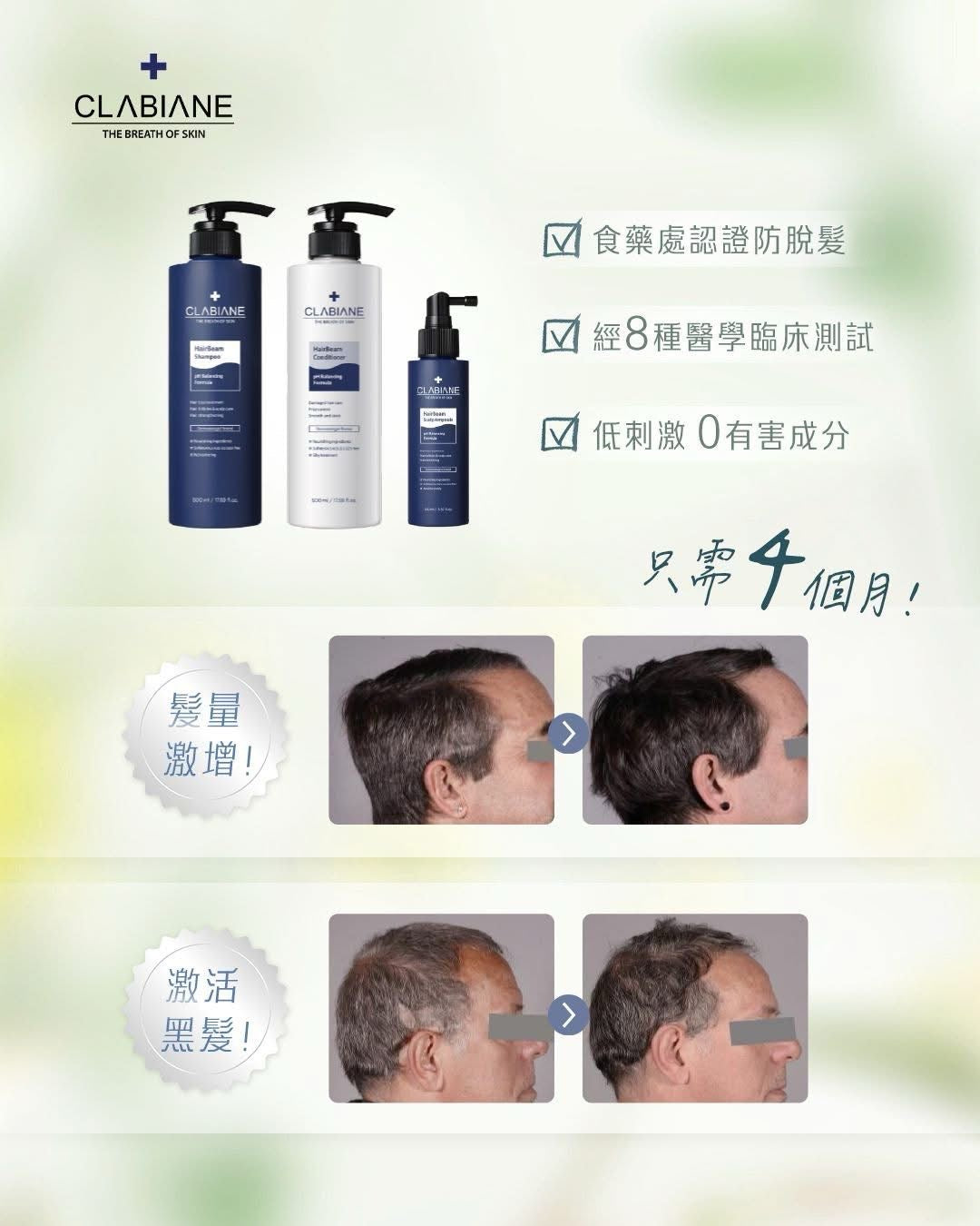美容家電 HairBeam II 頭皮ケア