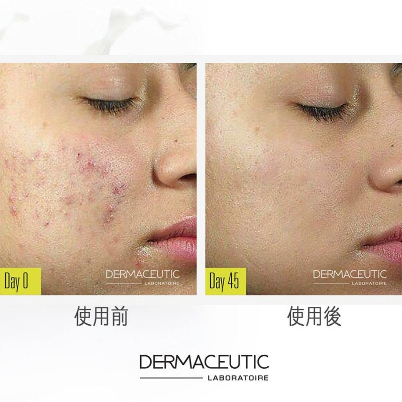 DERMACEUTIC Milk Peel｜奶滑果酸煥膚三酸淺層煥膚提亮控油淡痘收毛孔