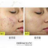 DERMACEUTIC MilkPeel Treatment Kit 奶滑果酸煥膚套盒 - 5SKINLAB