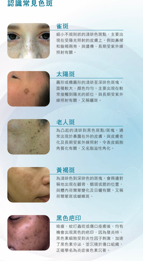 美國MD Pro專業淡斑美白霜 Depigmentation & Lightening Cream15G - 5SKINLAB