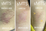 SMTS 幹細胞嬰兒針家用療程 水晶針x10 SMTS精華 面膜 防曬 洗面奶 - Beauty’s 5skin 