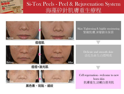 Lipo dermis矽針 陶瓷肌Lipodermis 海藻矽針 Si-Tox Peels - Peel & Rejuvenation TA/TA2/TA3 - Beauty’s 5skin 