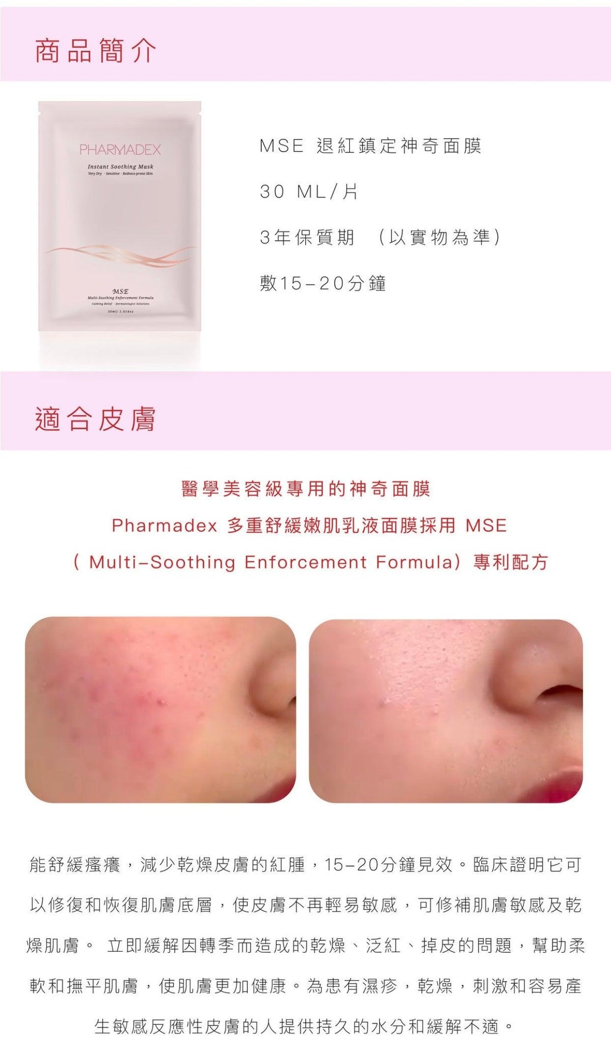 PHARMADEX MSE Instant Soothing Mask降紅修復補水面膜 - Beauty’s 5skin 