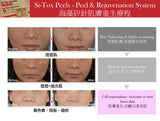 Lipodermis 海藻矽針 Si-Tox Peels - Peel & Rejuvenation TA/TA2/TA3 - Beauty’s 5skin 