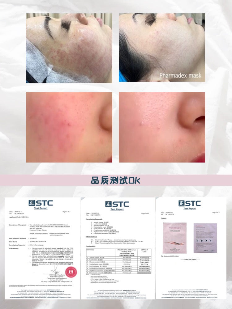 PHARMADEX MSE Instant Soothing Mask降紅修復補水面膜 - Beauty’s 5skin 