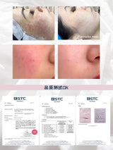 PHARMADEX MSE Instant Soothing Mask降紅修復補水面膜 - Beauty’s 5skin 